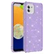Galaxy A03 Kılıf Zore Shining Silikon Galaxy A03 Kılıf Zore Shining Silikon