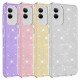 Galaxy A04 Kılıf Zore Shining Silikon Galaxy A04 Kılıf Zore Shining Silikon