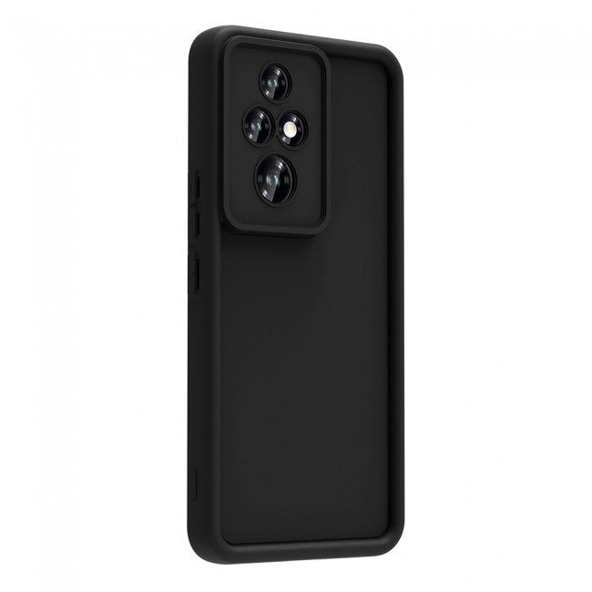 Honor 200 Pro Kılıf Kamera Korumalı Zore Ananas Kapak Honor 200 Pro Kılıf Kamera Korumalı Zore Ananas Kapak
