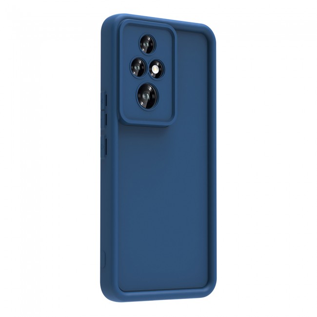 Honor 200 Pro Kılıf Kamera Korumalı Zore Ananas Kapak Honor 200 Pro Kılıf Kamera Korumalı Zore Ananas Kapak