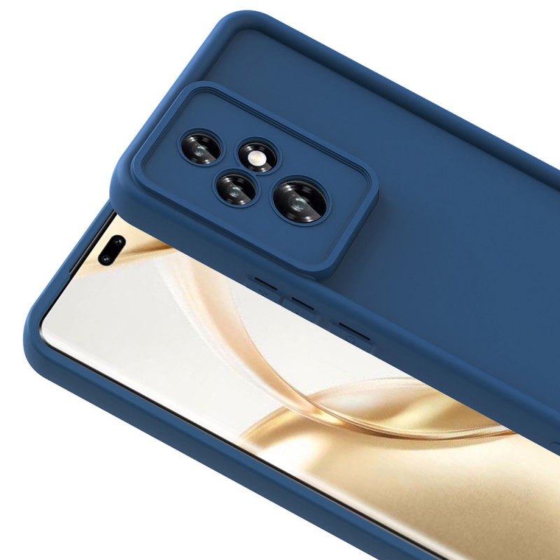 Bal-z Honor 200 Pro Kılıf Kamera Korumalı  Ananas Kapak