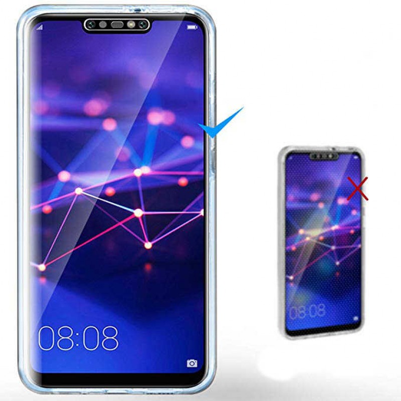 Bal-z Huawei Mate 20 Lite Kılıf  Enjoy Kapak