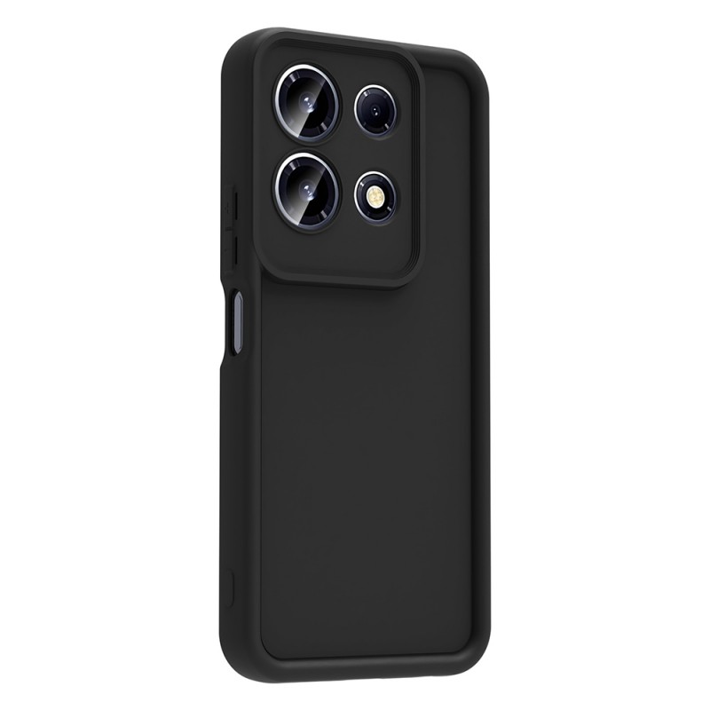 Bal-z İnfinix Note 30 4G Kılıf Kamera Korumalı Zore Ananas Kapak