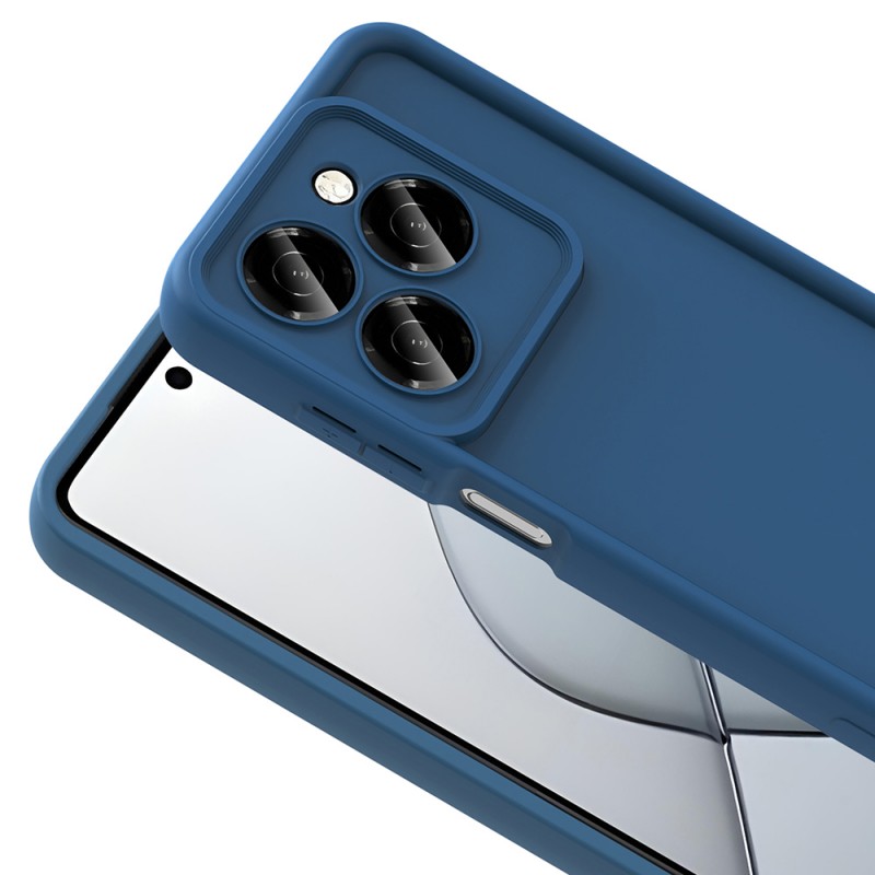 Bal-z Tecno Spark 20C Kılıf Kamera Korumalı Zore Ananas Kapak