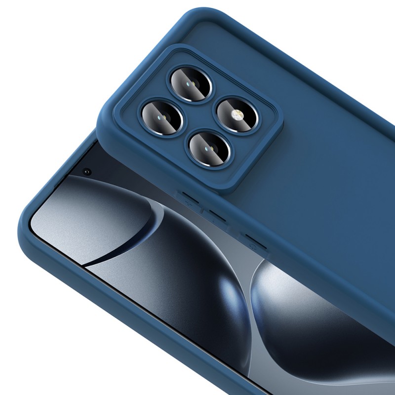 Bal-z Xiaomi 14T Kılıf Kamera Korumalı Zore Ananas Kapak