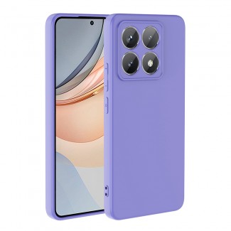 Xiaomi 14T Pro Kılıf Zore Mara Lansman Kapak Xiaomi 14T Pro Kılıf Zore Mara Lansman Kapak