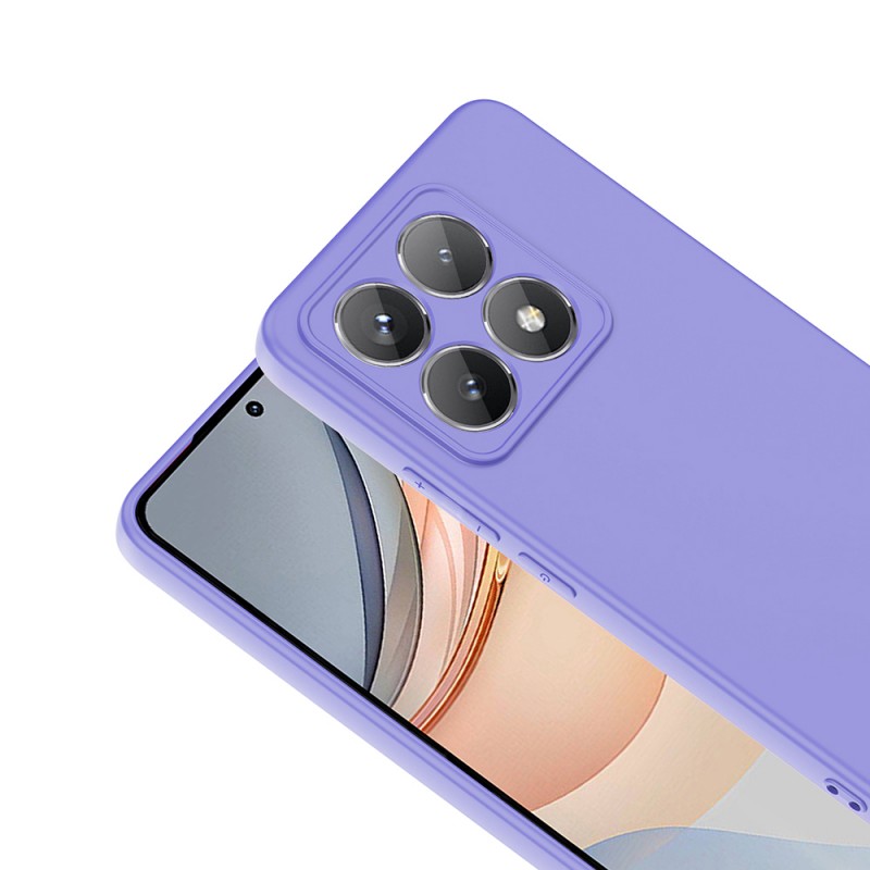 Bal-z Xiaomi 14T Pro Kılıf Zore Mara Lansman Kapak