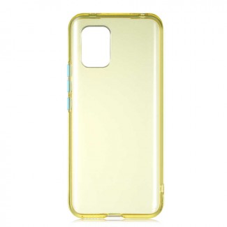 Xiaomi Mi 10 Lite Kılıf Zore Bistro Kapak Xiaomi Mi 10 Lite Kılıf Zore Bistro Kapak