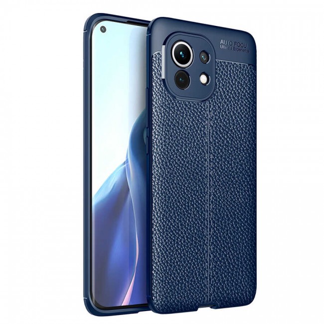 Xiaomi Mi 11 Kılıf Zore Niss Silikon Kapak Xiaomi Mi 11 Kılıf Zore Niss Silikon Kapak