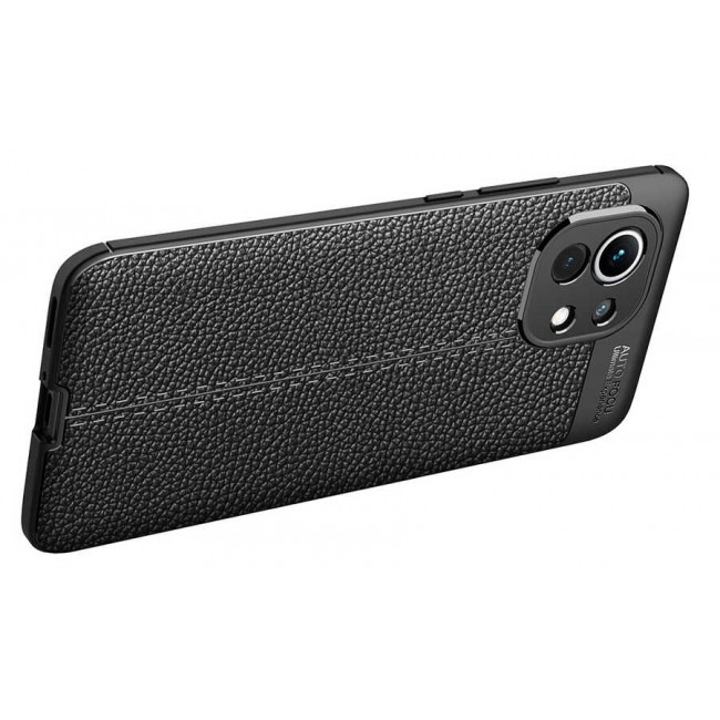 Xiaomi Mi 11 Kılıf Zore Niss Silikon Kapak Xiaomi Mi 11 Kılıf Zore Niss Silikon Kapak