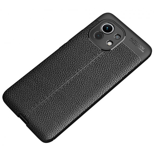 Xiaomi Mi 11 Kılıf Zore Niss Silikon Kapak Xiaomi Mi 11 Kılıf Zore Niss Silikon Kapak