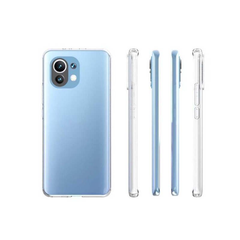 Bal-z Xiaomi Mi 11 Kılıf  Süper Silikon Kapak