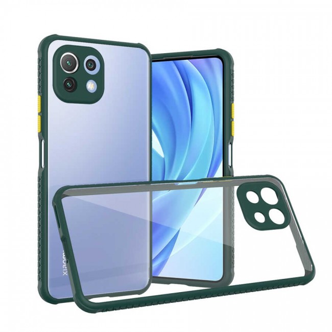 Xiaomi Mi 11 Lite Kılıf Zore Kaff Kapak Xiaomi Mi 11 Lite Kılıf Zore Kaff Kapak