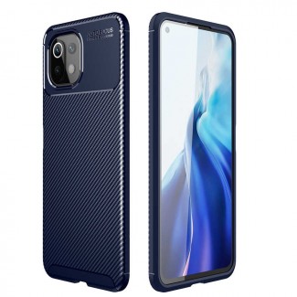 Xiaomi Mi 11 Lite Kılıf Zore Negro Silikon Kapak Xiaomi Mi 11 Lite Kılıf Zore Negro Silikon Kapak