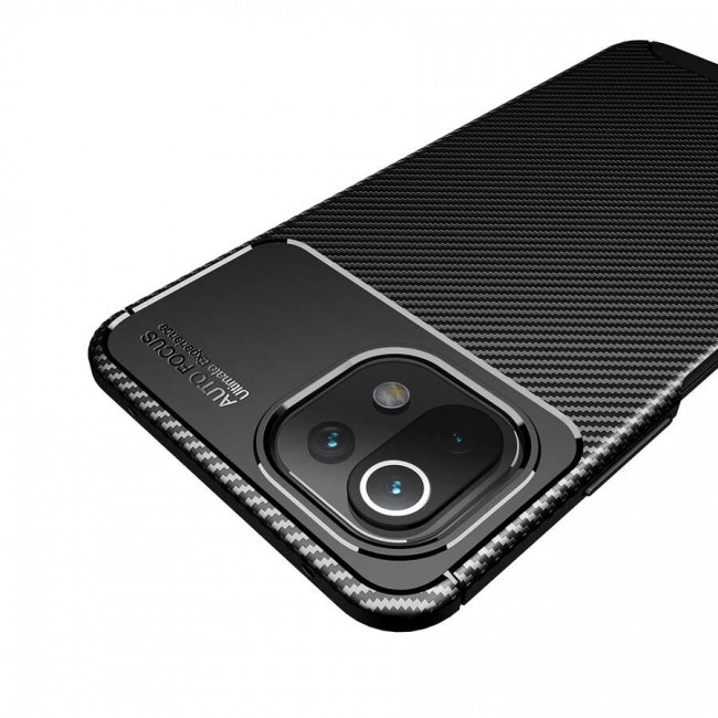 Xiaomi Mi 11 Lite Kılıf Zore Negro Silikon Kapak Xiaomi Mi 11 Lite Kılıf Zore Negro Silikon Kapak