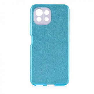 Xiaomi Mi 11 Lite Kılıf Zore Shining Silikon Xiaomi Mi 11 Lite Kılıf Zore Shining Silikon