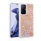Xiaomi Mi 11T 5G Kılıf Zore Milce Kapak Xiaomi Mi 11T 5G Kılıf Zore Milce Kapak