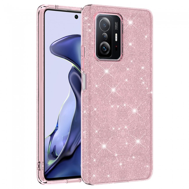 Xiaomi Mi 11T 5G Kılıf Zore Shining Silikon Xiaomi Mi 11T 5G Kılıf Zore Shining Silikon