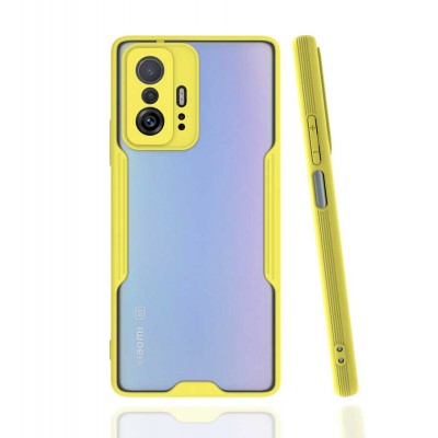 Bal-z Xiaomi Mi 11T Pro 5G Kılıf  Parfe Kapak