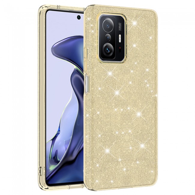 Xiaomi Mi 11T Pro 5G Kılıf Zore Shining Silikon Xiaomi Mi 11T Pro 5G Kılıf Zore Shining Silikon