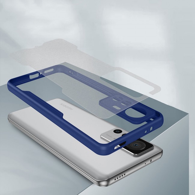 Xiaomi Mi 12T Kılıf Zore Parfe Kapak Xiaomi Mi 12T Kılıf Zore Parfe Kapak