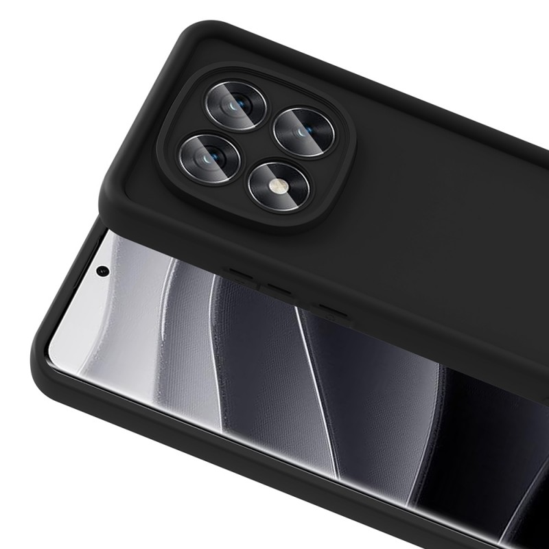 Bal-z Xiaomi Poco X7 Kılıf Kamera Korumalı Zore Ananas Kapak