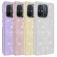 Xiaomi Redmi 12C Kılıf Zore Shining Silikon Xiaomi Redmi 12C Kılıf Zore Shining Silikon