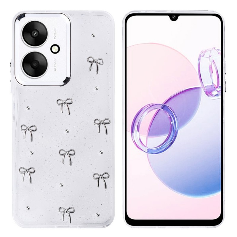 Bal-z Xiaomi Redmi 13C Kılıf Airbag Tasarımlı Simli Şeffaf Zore Kutup Kapak