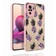 Xiaomi Redmi Note 10 Kılıf Desenli Kamera Korumalı Parlak Zore Nora Kapak Xiaomi Redmi Note 10 Kılıf Desenli Kamera Korumalı Parlak Zore Nora Kapak