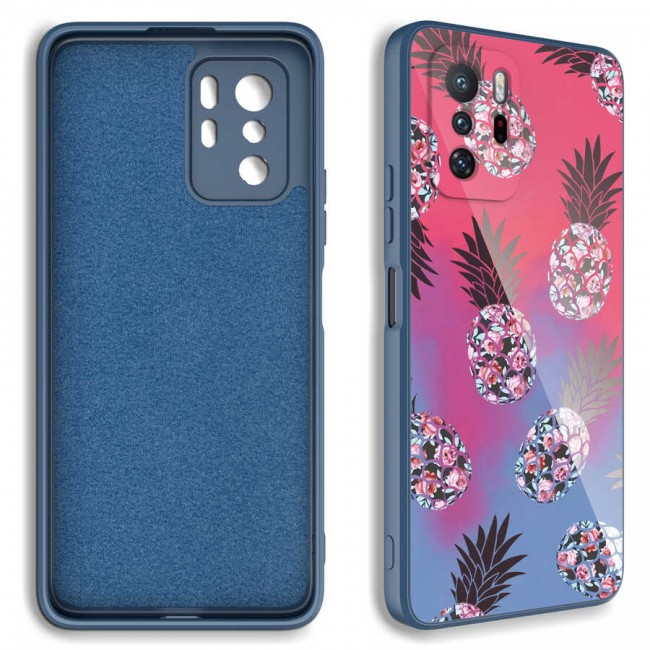 Xiaomi Redmi Note 10 Pro Kılıf Kamera Korumalı Desenli Sert Silikon Zore Epoksi Kapak Xiaomi Redmi Note 10 Pro Kılıf Kamera Korumalı Desenli Sert Silikon Zore Epoksi Kapak