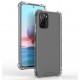 Xiaomi Redmi Note 10S Kılıf Zore Nitro Anti Shock Silikon Xiaomi Redmi Note 10S Kılıf Zore Nitro Anti Shock Silikon