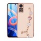 Xiaomi Redmi Note 11 Global Kılıf El Tutamaçlı Kamera Korumalı Zore Taka Silikon Kapak Xiaomi Redmi Note 11 Global Kılıf El Tutamaçlı Kamera Korumalı Zore Taka Silikon Kapak