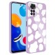Xiaomi Redmi Note 11 Global Kılıf Kamera Korumalı Desenli Sert Silikon Zore Epoksi Kapak Xiaomi Redmi Note 11 Global Kılıf Kamera Korumalı Desenli Sert Silikon Zore Epoksi Kapak
