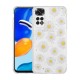 Xiaomi Redmi Note 11 Global Kılıf Simli Desenli Kamera Korumalı Parlak Zore Popy Kapak Xiaomi Redmi Note 11 Global Kılıf Simli Desenli Kamera Korumalı Parlak Zore Popy Kapak