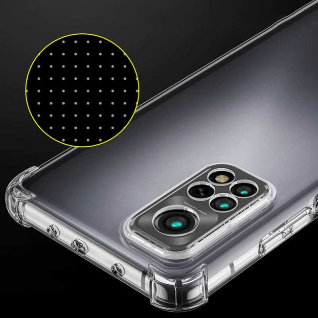 Xiaomi Redmi Note 11 Global Kılıf Zore Kamera Korumalı Nitro Anti Shock Silikon Xiaomi Redmi Note 11 Global Kılıf Zore Kamera Korumalı Nitro Anti Shock Silikon