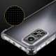 Xiaomi Redmi Note 11 Global Kılıf Zore Kamera Korumalı Nitro Anti Shock Silikon Xiaomi Redmi Note 11 Global Kılıf Zore Kamera Korumalı Nitro Anti Shock Silikon
