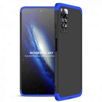 Xiaomi Redmi Note 11 Pro 5G Kılıf Zore Ays Kapak Xiaomi Redmi Note 11 Pro 5G Kılıf Zore Ays Kapak