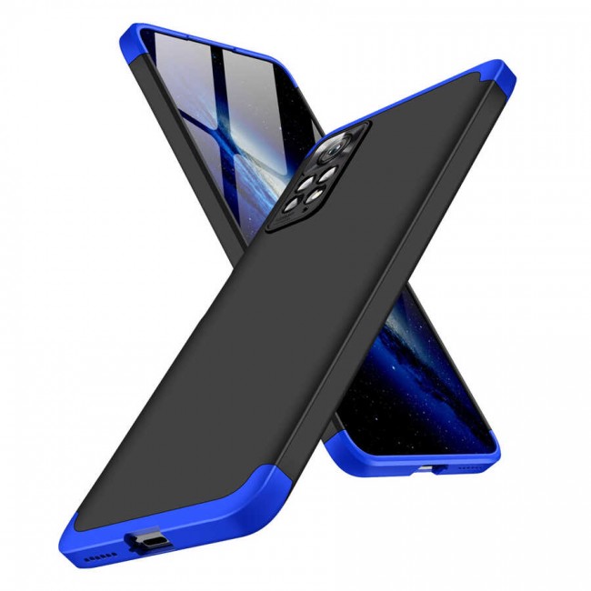 Xiaomi Redmi Note 11 Pro 5G Kılıf Zore Ays Kapak Xiaomi Redmi Note 11 Pro 5G Kılıf Zore Ays Kapak