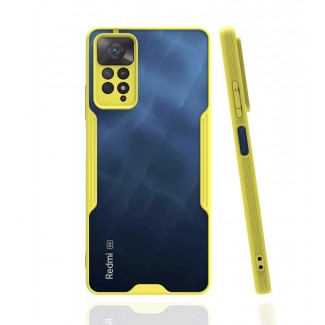 Xiaomi Redmi Note 11 Pro 5G Kılıf Zore Parfe Kapak Xiaomi Redmi Note 11 Pro 5G Kılıf Zore Parfe Kapak