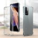 Xiaomi Redmi Note 11 Pro Plus 5G Kılıf Zore Nitro Anti Shock Silikon Xiaomi Redmi Note 11 Pro Plus 5G Kılıf Zore Nitro Anti Shock Silikon