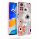 Xiaomi Redmi Note 11S Global Kılıf Desenli Kamera Korumalı Parlak Zore Nora Kapak Xiaomi Redmi Note 11S Global Kılıf Desenli Kamera Korumalı Parlak Zore Nora Kapak