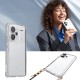 Xiaomi Redmi Note 13 Pro Plus 5G Kılıf Airbagli Takılabilir Askı Aparatlı Zore Snap Silikon Kapak Xiaomi Redmi Note 13 Pro Plus 5G Kılıf Airbagli Takılabilir Askı Aparatlı Zore Snap Silikon Kapak