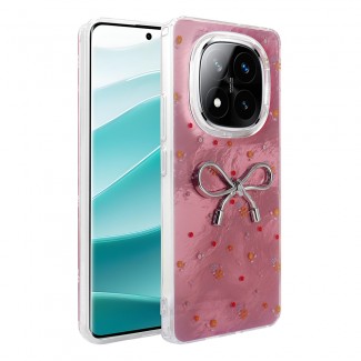 Xiaomi Redmi Note 14 Pro Plus Kılıf Kamera Korumalı Figürlü Zore Ponti Silikon Kapak Xiaomi Redmi Note 14 Pro Plus Kılıf Kamera Korumalı Figürlü Zore Ponti Silikon Kapak